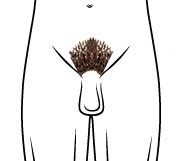 C’est une forme plus échancrée que le maillot simple.La zone du pubis à épiler est la même que pour le maillot bikini, donc échancré, excepté que cette fois ci les poils du pénis et du scrotum sont traités.
